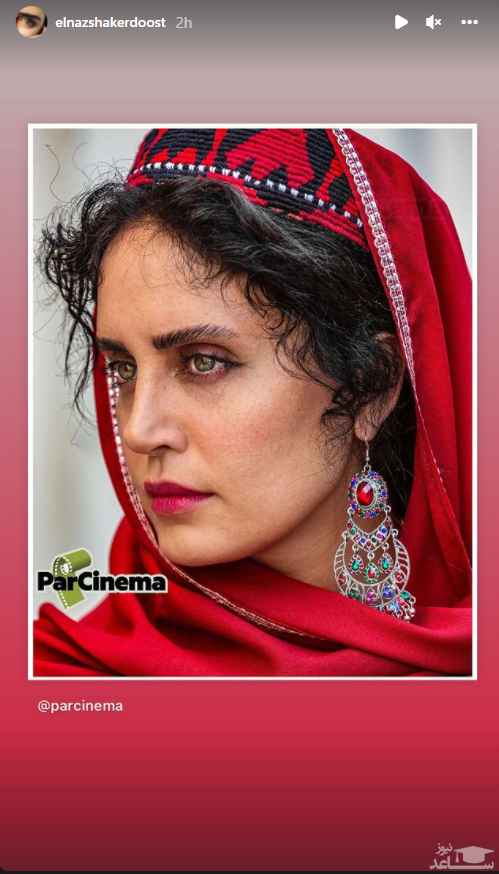 چهره درهم ریخته و شکسته الناز شاکردوست + عکس چهره درهم ریخته و شکسته الناز شاکردوست + عکس