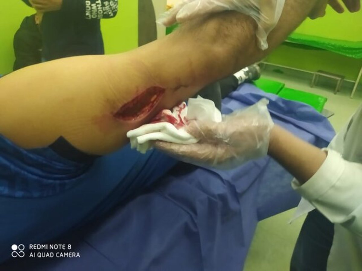 چاقوکشی وحشتناك بعد از بازى استقلال!/عكس