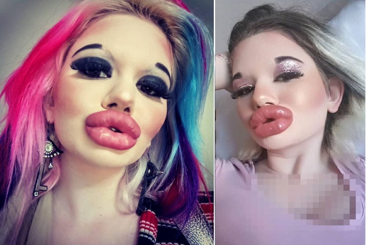 دختری با بزرگترین لبهای دنیا دختری با بزرگترین لبهای دنیا