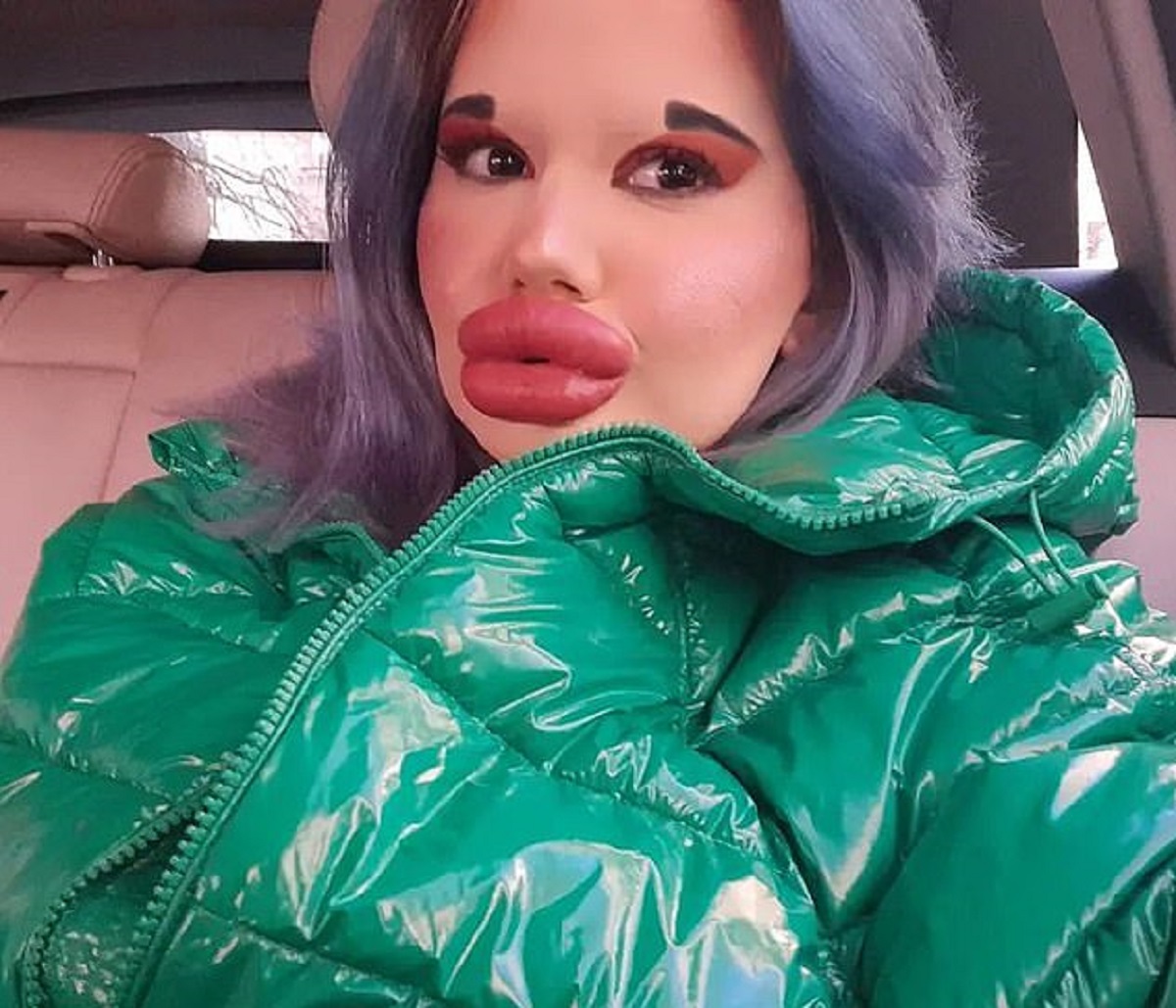 دختری که بزرگترین لبهای دنیا را دارد! + تصاویر دختری که بزرگترین لبهای دنیا را دارد! + تصاویر