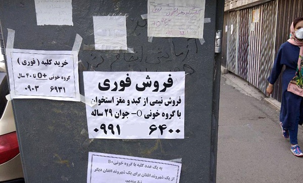 فروش کلیه فروش کلیه