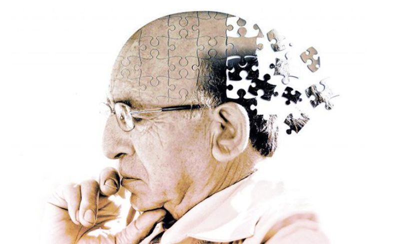 آلزایمر آلزایمر