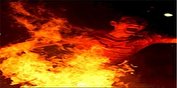 برخورد ترقه با چشمان پسر ۱۲ ساله