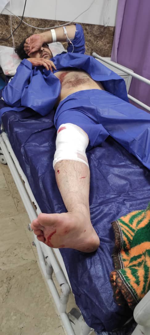 حمله سارقان به عکاس خبری/ دهها ضربه چاقو برای سرقت دوربین عکاسی حمله سارقان به عکاس خبری/ دهها ضربه چاقو برای سرقت دوربین عکاسی