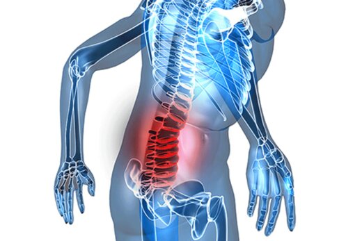از زنجبیل تا زردچوبه؛ درمان دردها بدون نیاز به داروی مسکن درمان خانگی بیماری ها