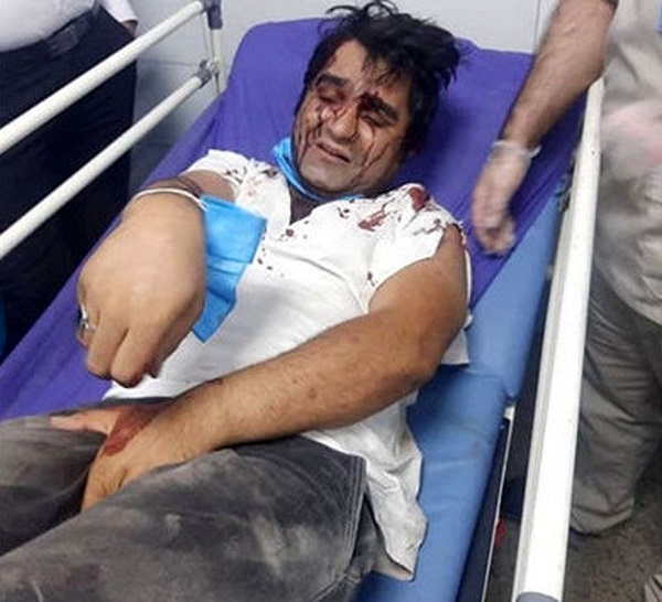 بازیگر سریال دودکش