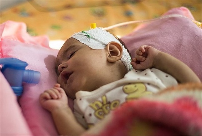 بیماران نادر بیماران نادر