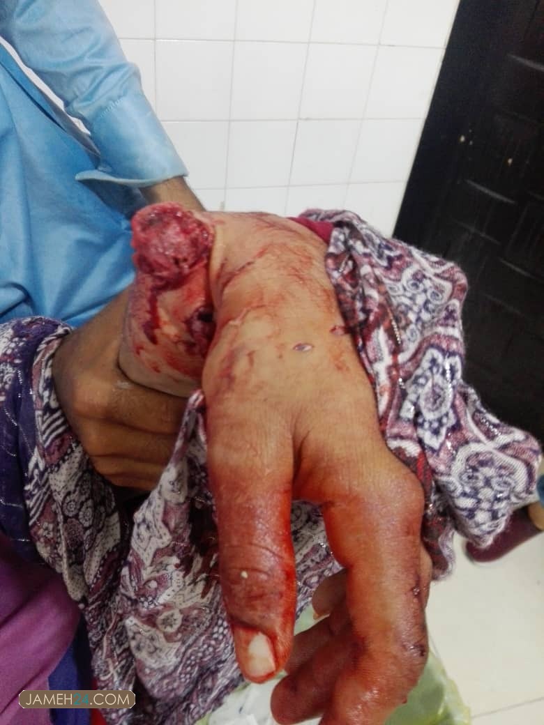 حمله گاندو به یک جوان روستایی در نبود جاده/ چه کسی پاسخگوست؟ حمله گاندو به یک جوان روستایی در نبود جاده/ چه کسی پاسخگوست؟