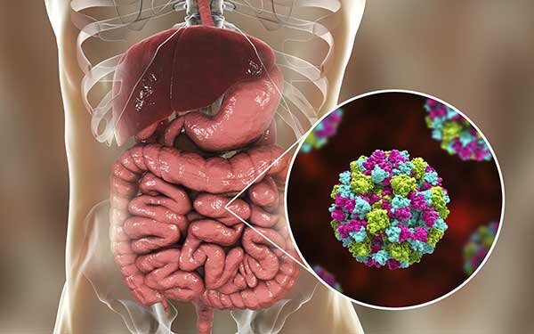 شیوع نوروویروس در انگلیس نوروویروس