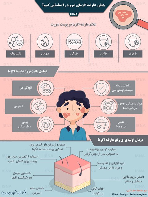 شناسایی عارضه اگزمای صورت/ اینفوگرافی
