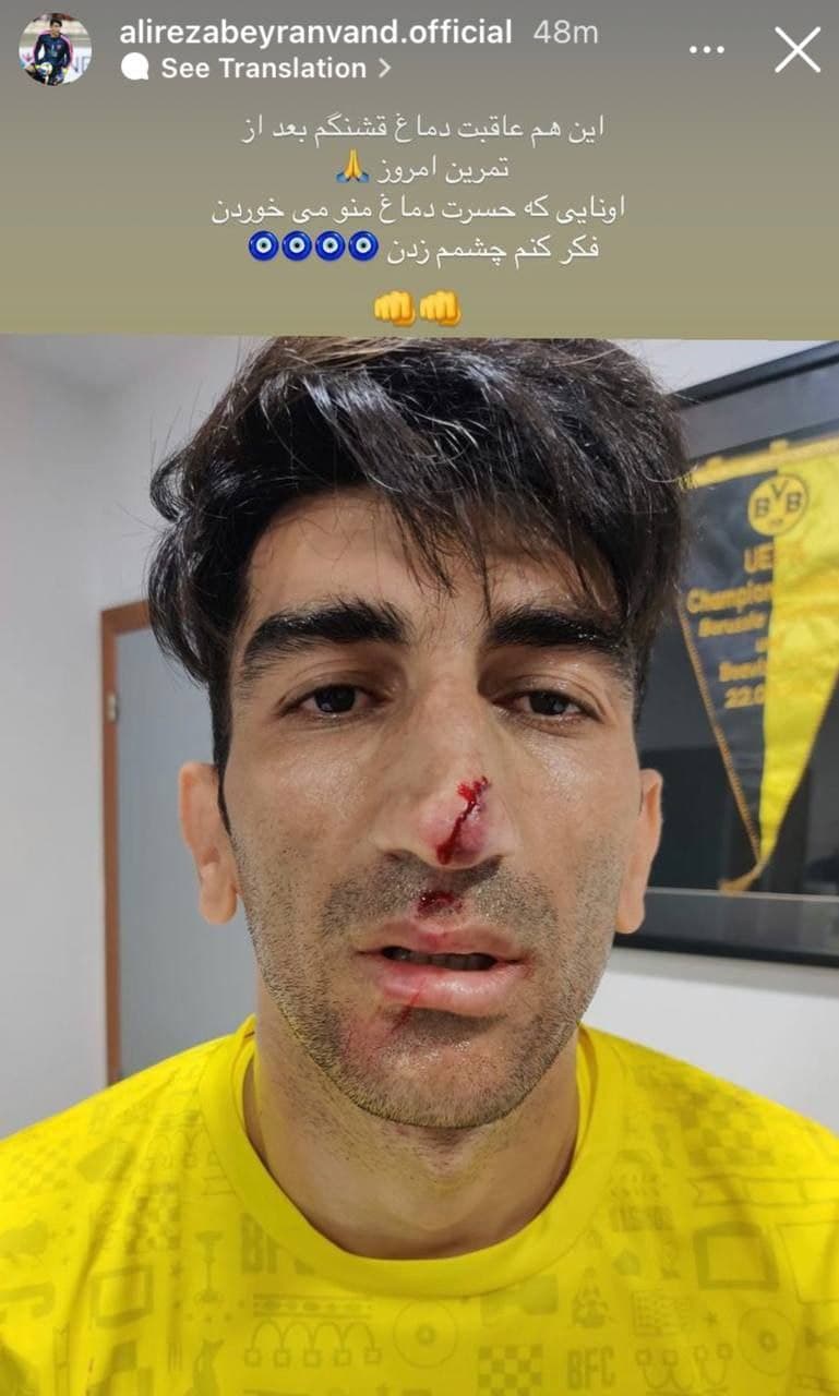 خونریزی بینی بیرانوند در تمرین + عکس خونریزی بینی بیرانوند در تمرین + عکس