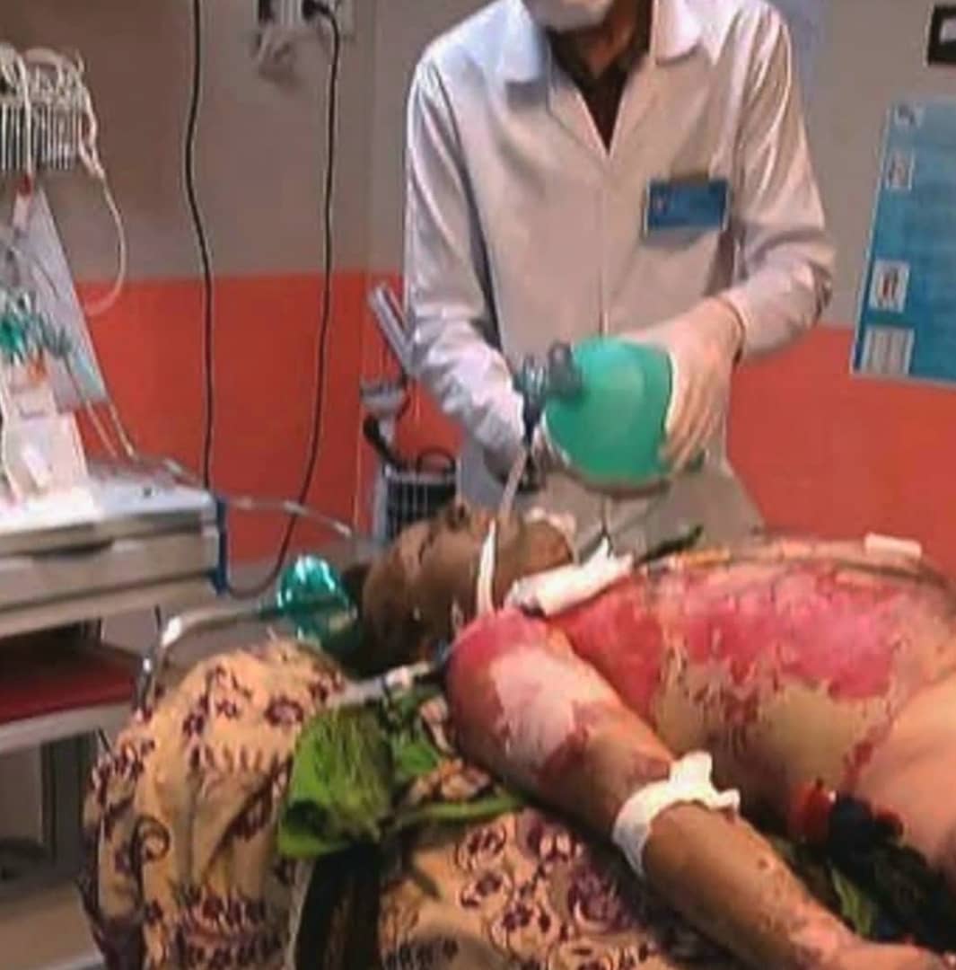 آتش افروزی در جنگلهای کشور آتش افروزی در جنگلهای کشور