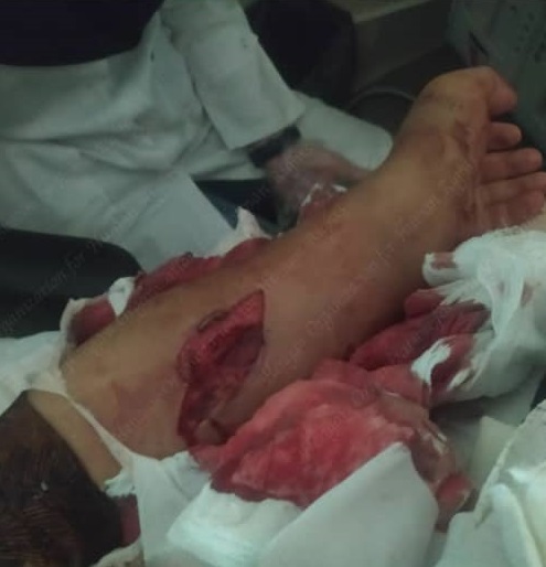 رواج همسر آزاری در ایران رواج همسر آزاری در ایران