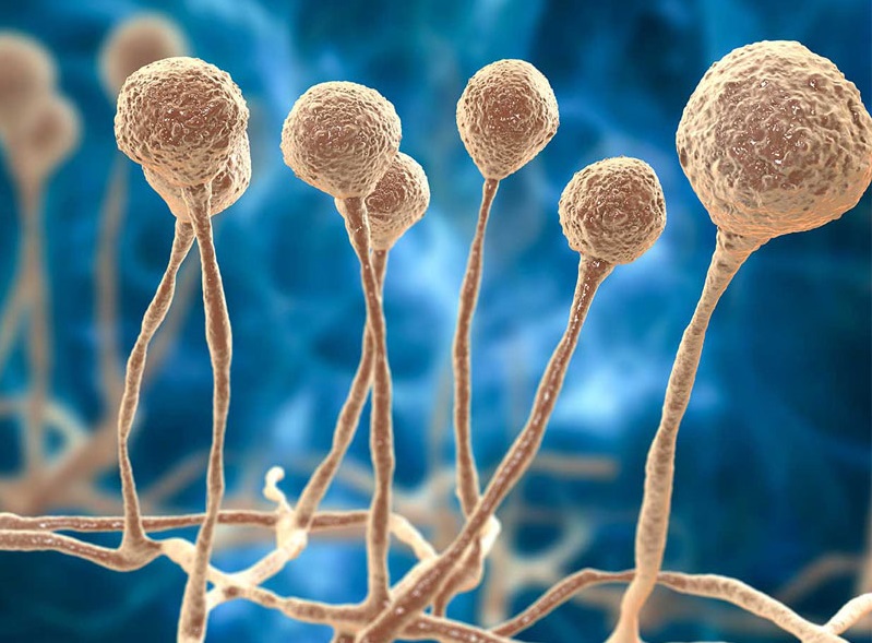 هزینه درمان قارچ سیاه هزینه درمان قارچ سیاه