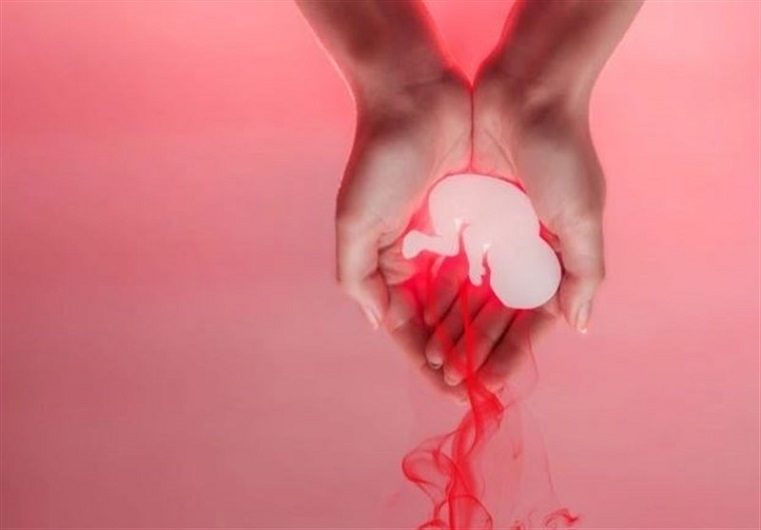 قوانین سقط جنین قوانین سقط جنین