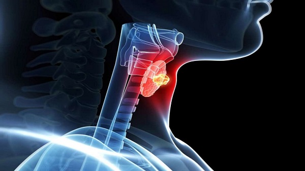 مبتلایان به تیروئید این خوراکیها را مصرف کنند مبتلایان به تیروئید این خوراکیها را مصرف کنند