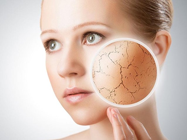 عادتهای اشتباه که شما را زشت میکنند! عادتهای اشتباه که باعث زشتی می شوند