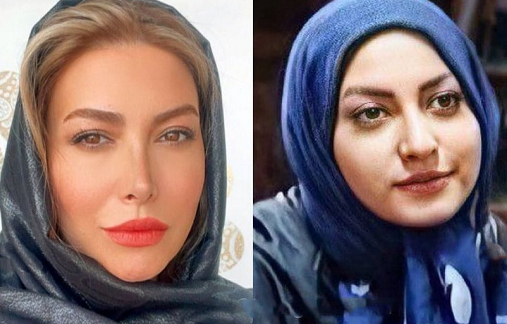 چهره متفاوت فریبا نادری قبل از عمل بینی + عکس