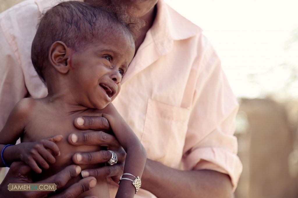 بحران انسانی در یمن/ تصاویر