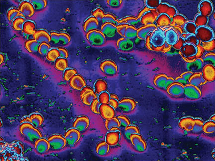 راز جوانی با پیوند مدفوع در چیست؟ راز جوانی با پیوند مدفوع در چیست؟