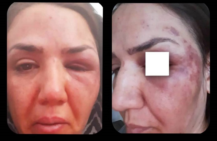 سرقت مسلح از خانم دکتر