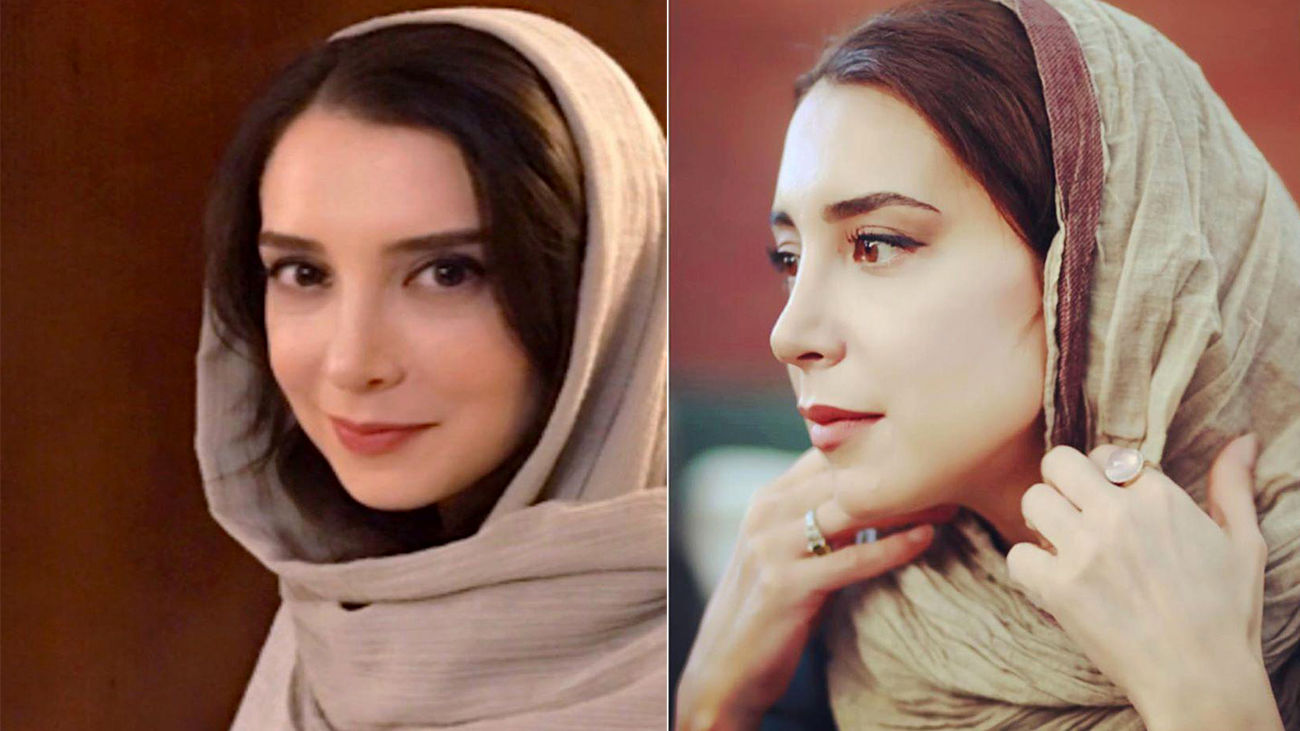 عمل زیبایی سحر جعفری جوزانی عمل زیبایی سحر جعفری جوزانی