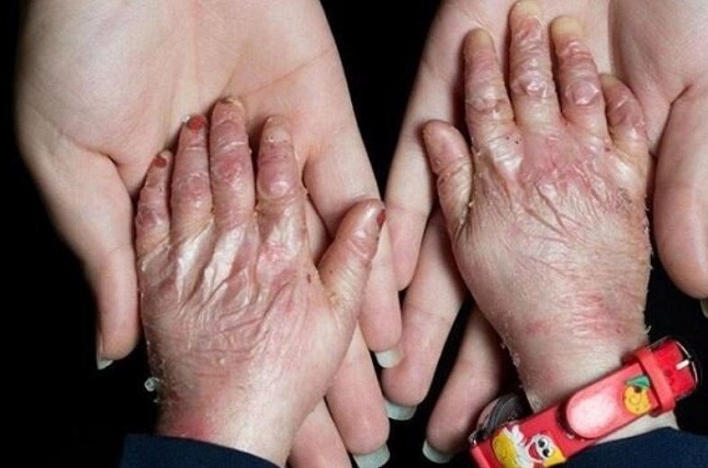  درخواست رئیس بنیاد امور بیماریهای خاص از رئیس جمهور درخواست رئیس بنیاد امور بیماریهای خاص از رئیس جمهور