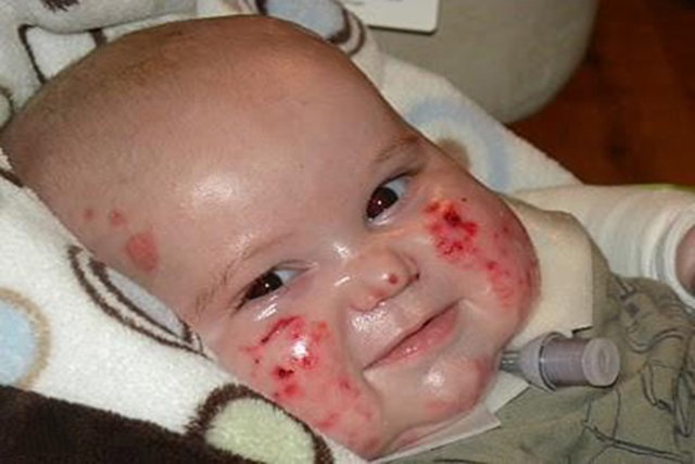 برگزاری دادگاه رسیدگی به پرونده بیماران پروانهای برگزاری دادگاه رسیدگی به پرونده بیماران پروانهای