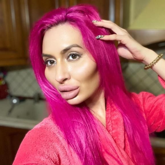 رکورد بزرگترین گونههای دنیا بدست این خانم شکسته شد رکورد بزرگترین گونههای دنیا بدست این خانم شکسته شد