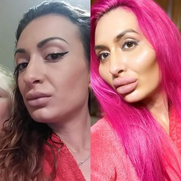 رکورد بزرگترین گونههای دنیا بدست این خانم شکسته شد رکورد بزرگترین گونههای دنیا بدست این خانم شکسته شد