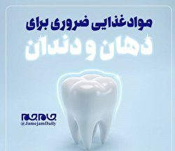موادغذایی ضروری برای دهان و دندان/ اینفوگرافیک