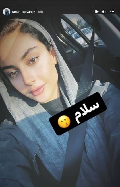 چهره متفاوت سر صبحی ترلان پروانه بدون آرایش