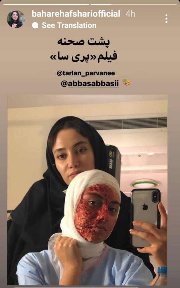 عکسی که بهاره افشاری از صورت باندپیچیشده ترلان پروانه منتشر کرد عکسی که بهاره افشاری از صورت باندپیچیشده ترلان پروانه منتشر کرد