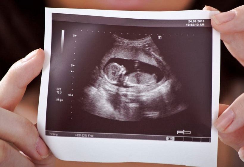 حقایق تحدید غربالگری جنین حقایق تحدید غربالگری جنین