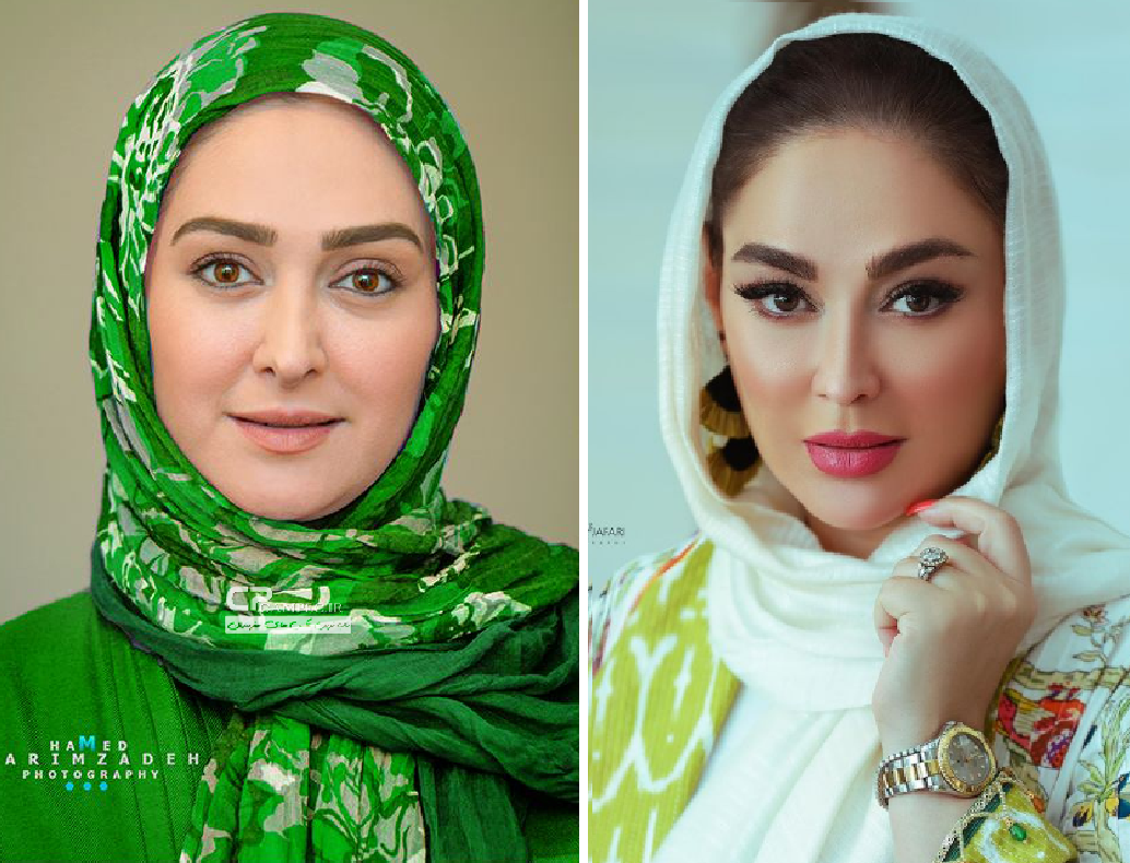 تغییر چهره محسوس الهام حمیدی نسبت به سالهای گذشته + عکس تغییر چهره محسوس الهام حمیدی نسبت به سالهای گذشته + عکس