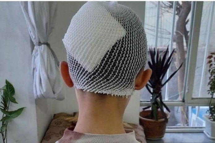 شکستن سر دانشآموز به دست آموزگار در آذربایجان غربی آموزش و پرورش