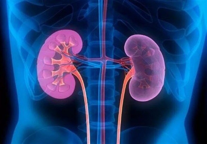 روزهداری در بیماران کلیوی بیماران کلیوی