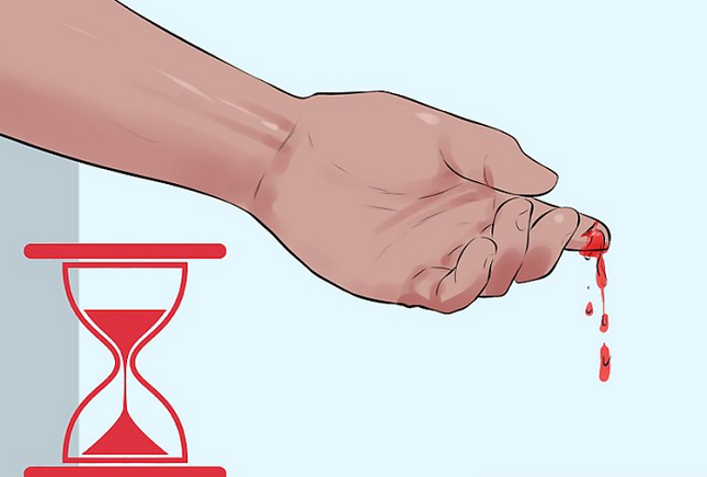 چه خونریزیهای نشانه هموفیلی است چه خونریزیهای نشانه هموفیلی است