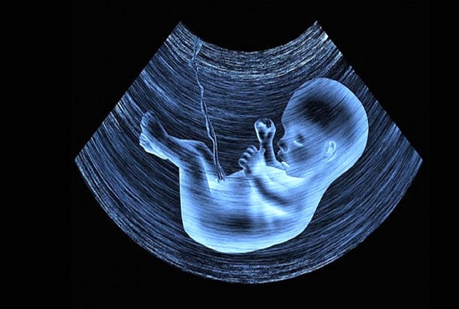 تعیین غربالگری جنین در وزارت بهداشت تعیین غربالگری جنین در وزارت بهداشت