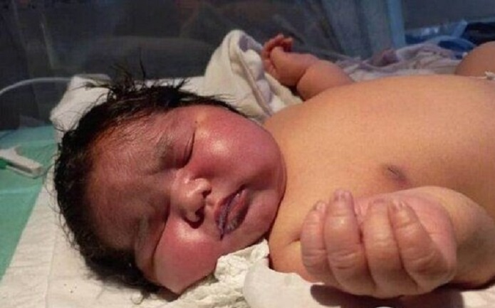 زادهشدن سنگینترین نوزاد دنیا در مشهد نوزاد