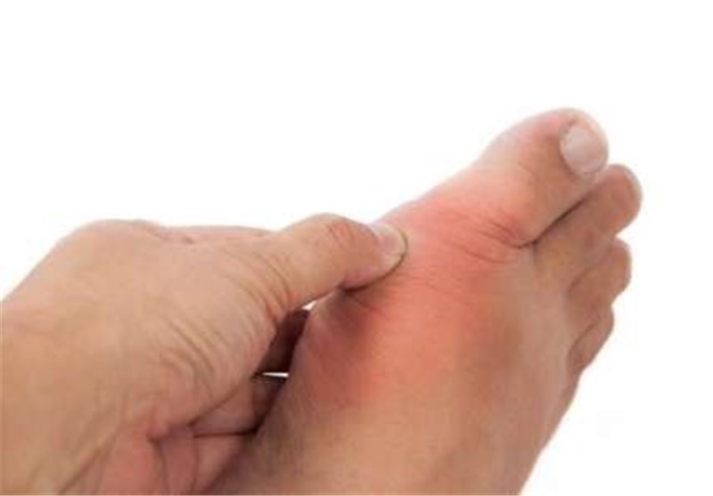 اگر نقرس دارید این خوراکیها را مصرف کنید اگر نقرس دارید این خوراکیها را مصرف کنید