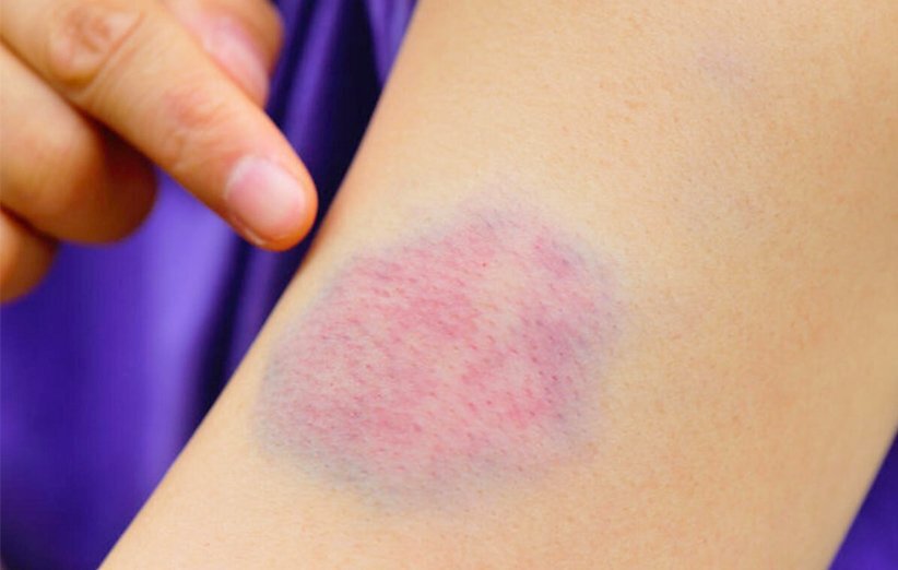 مراقبت از پوست مراقبت از پوست