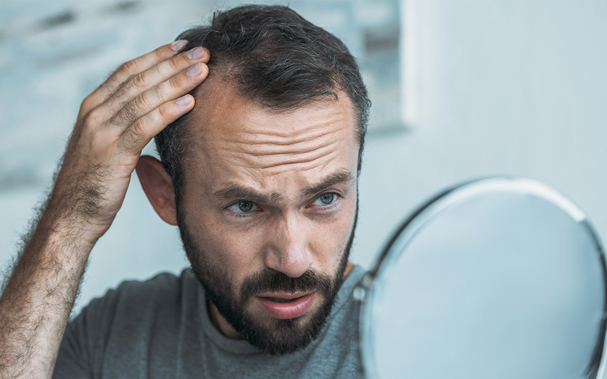 ریزش مو در مردها و روشهای درمان آن ریزش مو در مردها و روشهای درمان آن