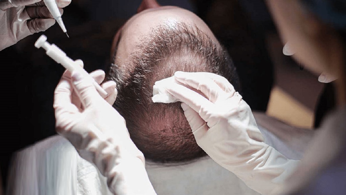 ریزش مو در مردها و روشهای درمان آن ریزش مو در مردها و روشهای درمان آن