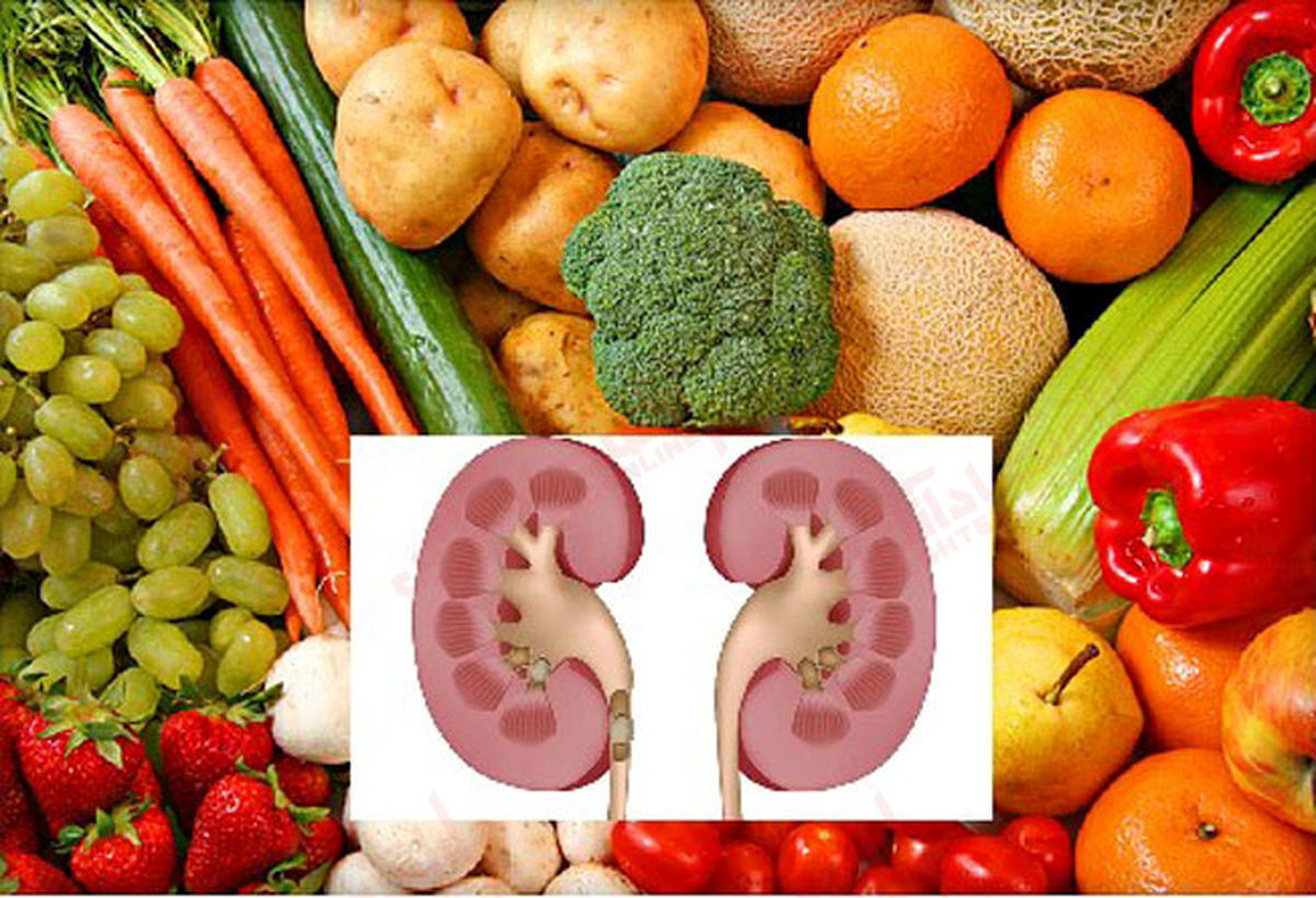 درمان سنگ کلیه با این خوراکی ها