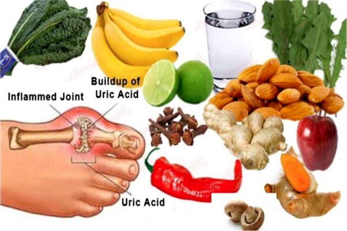 اگر مبتلا به نقرص هستید این خوراکیها را نخورید اگر مبتلا به نقرص هستید این خوراکیها را نخورید