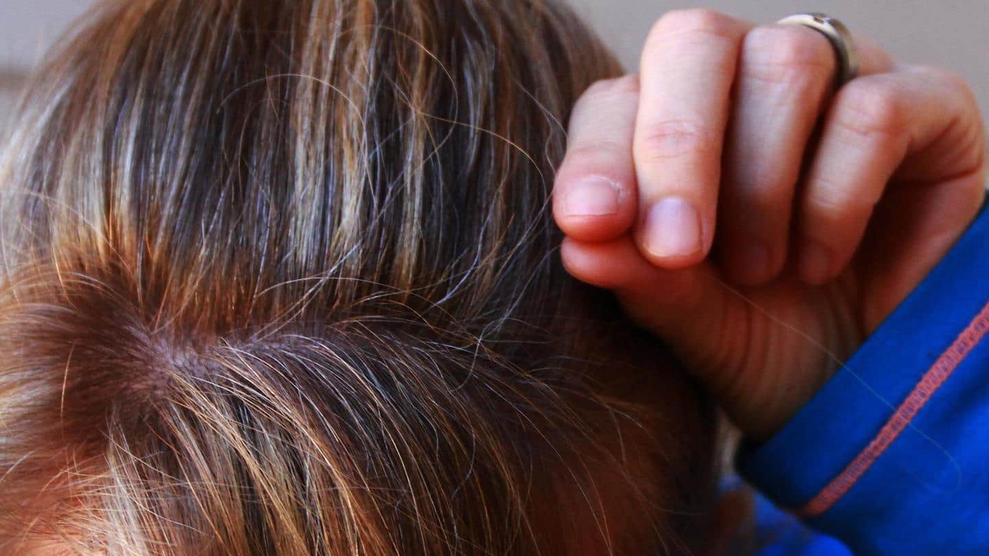 چرا نباید موهای سفید را از ریشه کند؟