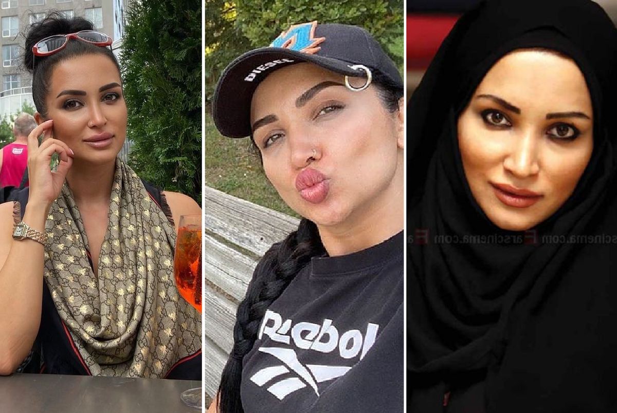 چهره متفاوت روناک رونسی پس از عملهای زیبایی + عکس چهره متفاوت روناک رونسی پس از عملهای زیبایی + عکس