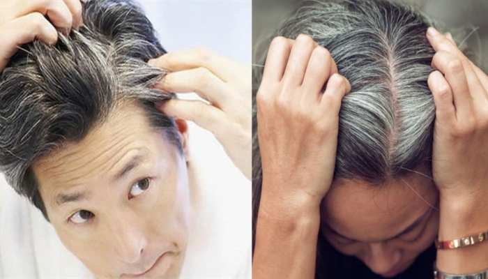 با چه چیزهایی سفیدی موهایمان را کم کنیم؟