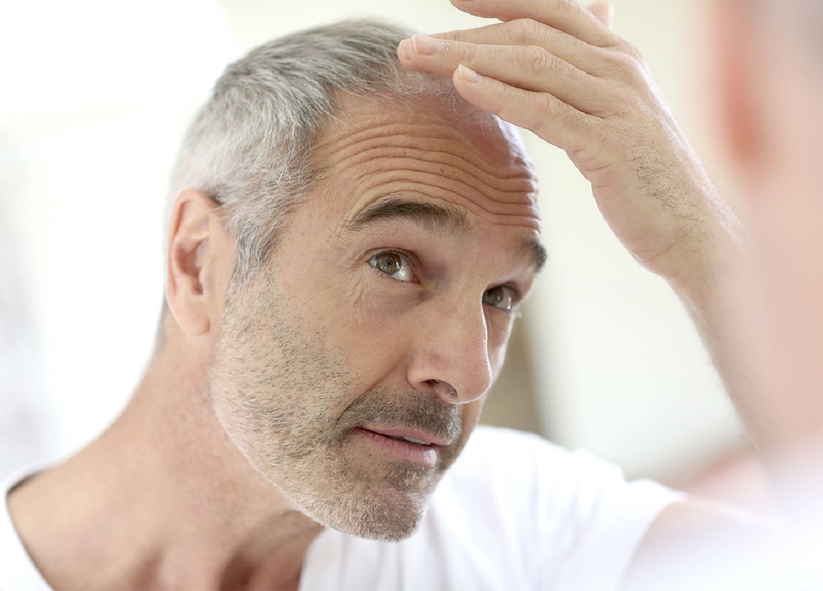 راه های جلوگیری از سفید شدن مو